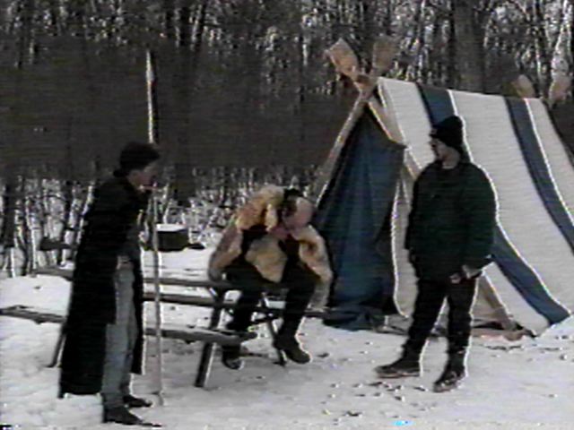 The third degree (burns)